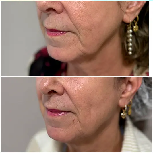 Estética Regenerativa