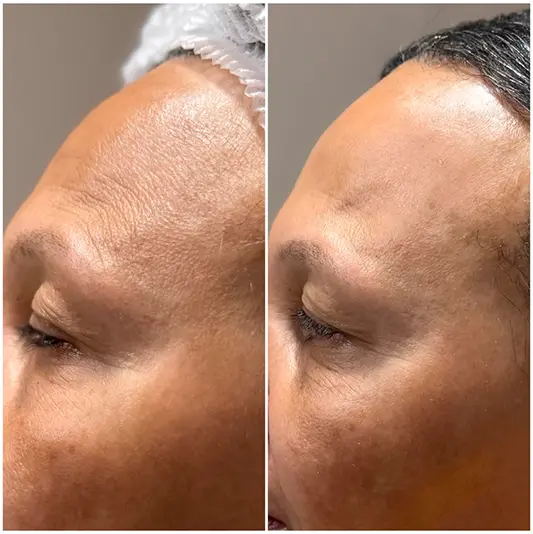 Estética Regenerativa